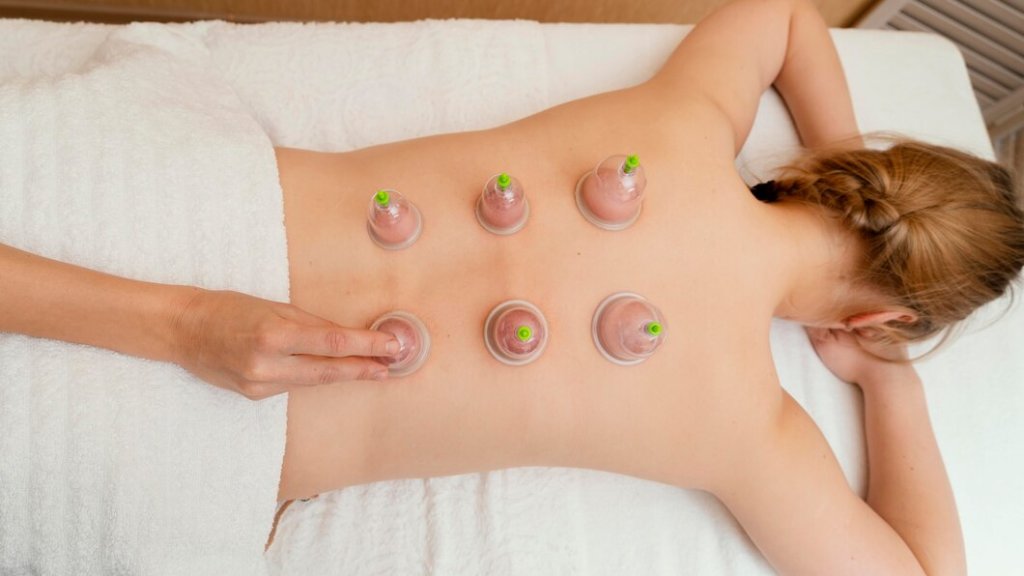 woman-experiencing-cupping-therapy_23-2148882160.jpg